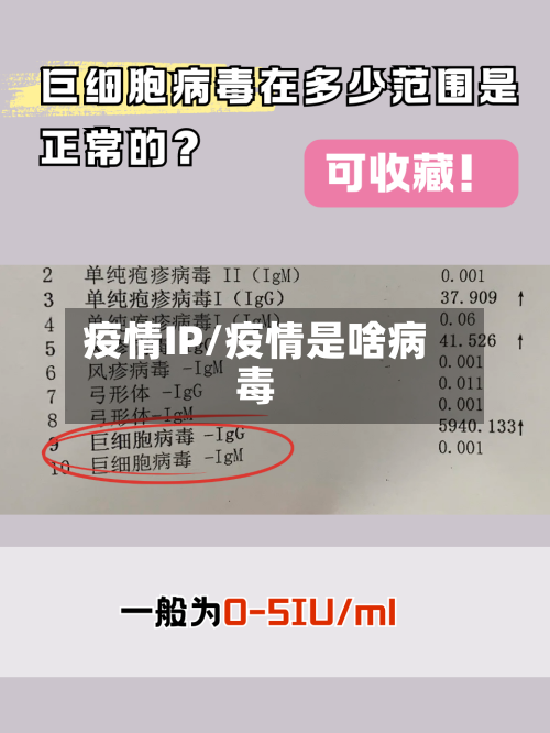 疫情IP/疫情是啥病毒