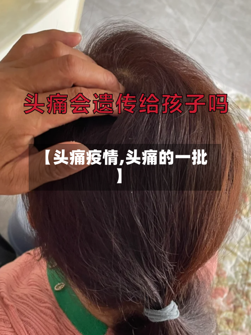 【头痛疫情,头痛的一批】