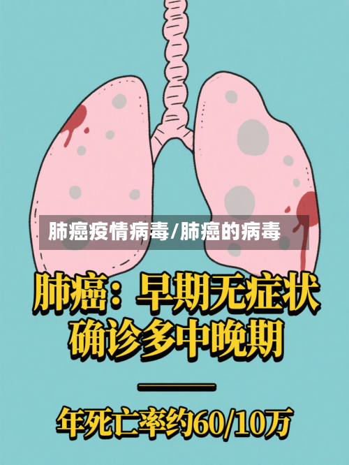 肺癌疫情病毒/肺癌的病毒